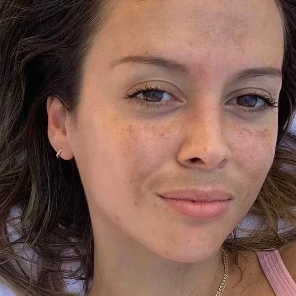 Before transformation